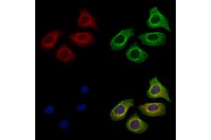 ABIN6264915 and ABIN6278028 staining Hela cells by IF/ICC.