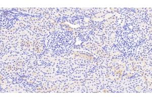 Immunohistochemistry (IHC) image for anti-NADH Dehydrogenase (Ubiquinone) Fe-S Protein 1, 75kDa (NADH-Coenzyme Q Reductase) (NDUFS1) (AA 524-727) antibody (ABIN7441598)