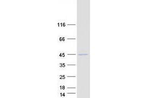 Western Blotting (WB) image for Prostaglandin Reductase 2 (PTGR2) (Transcript Variant 3) protein (Myc-DYKDDDDK Tag) (ABIN2735751)