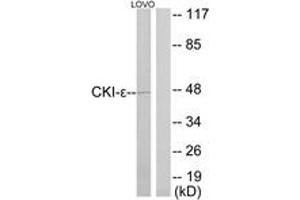 Western blot analysis of extracts from LOVO cells, using CKI-epsilon Antibody. (CK1 epsilon 抗体  (AA 276-325))