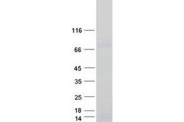 FAM161A Protein (Myc-DYKDDDDK Tag)