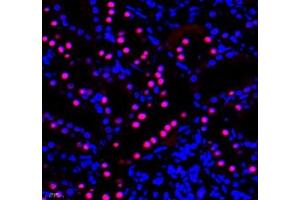 Immunofluorescence of paraffin embedded rat kidney using PRPF3 (ABIN7075311) at dilution of 1: 2200 (400x lens)