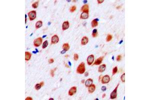 Immunohistochemical analysis of Neurotrimin staining in human brain formalin fixed paraffin embedded tissue section. (Neurotrimin 抗体  (C-Term))
