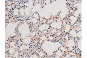 ABIN6267601 at 1/200 staining Mouse lung tissue sections by IHC-P. (NF-kB p65 抗体  (pThr435))