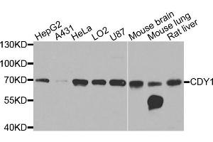 Western blot analysis of extracts of various cells, using CDY1 antibody. (CDY1 抗体)