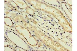 Immunohistochemistry of paraffin-embedded human kidney tissue using ABIN7156549 at dilution of 1:100 (IFNa14 抗体  (AA 24-189))