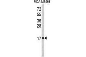 Western blot analysis of IL8 Antibody (C-term) in MDA-MB468 cell line lysates (35ug/lane).
