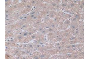 IHC-P analysis of Human Kidney Tissue, with DAB staining. (NOTCH4 抗体  (AA 1715-2001))