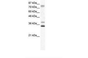 Image no. 1 for anti-Zinc Finger Protein 570 (ZNF570) (AA 68-117) antibody (ABIN6736005) (ZNF570 抗体  (AA 68-117))