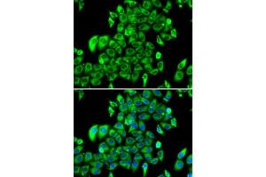 Immunofluorescence analysis of MCF-7 cells using RPL13 antibody. (RPL13 抗体  (AA 1-211))