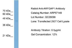 WB Suggested Anti-ARFGAP1  Antibody Titration: 0. (ARFGAP1 抗体  (Middle Region))