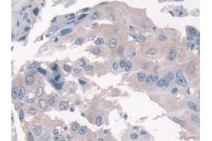 Immunohistochemistry (IHC) image for anti-Kinesin Light Chain 1 (KLC1) (AA 1-254) antibody (ABIN7434992)