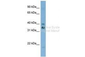 Image no. 1 for anti-General Transcription Factor IIH, Polypeptide 2, 44kDa (GTF2H2) (AA 323-372) antibody (ABIN6742059)