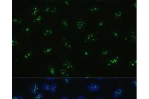 Immunofluorescence analysis of U-2 OS cells using NOLC1 Polyclonal Antibody at dilution of 1:100. (NOLC1 抗体)
