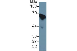Western Blot; Sample: Human Serum; Primary Ab: 1µg/ml Rabbit Anti-Human CDC25B Antibody Second Ab: 0. (CDC25B 抗体  (AA 377-566))