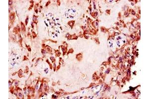 Immunohistochemistry of paraffin-embedded human placenta tissue using ABIN7156151 at dilution of 1:100 (NAALADL2 抗体  (AA 143-795))