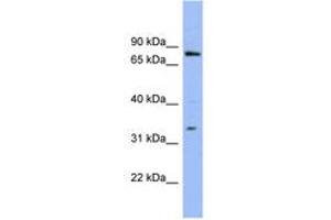 Image no. 1 for anti-Zinc Finger Protein 278 (ZNF278) (AA 35-84) antibody (ABIN6741631) (PATZ1 抗体  (AA 35-84))
