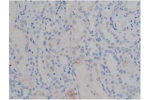 ABIN6267355 at 1/200 staining Human kidney tissue sections by IHC-P. (MAPT 抗体  (pSer356))