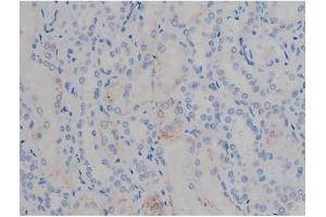 ABIN6267355 at 1/200 staining Human kidney tissue sections by IHC-P. (MAPT 抗体  (pSer356))