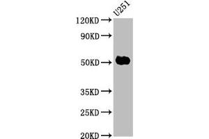 Western Blot Positive WB detected in: U251 whole cell lysate All lanes: FEZF1 antibody at 6 μg/mL Secondary Goat polyclonal to rabbit IgG at 1/50000 dilution Predicted band size: 53, 47, 52 kDa Observed band size: 53 kDa (FEZF1 抗体  (AA 1-115))