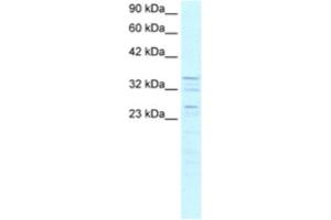 Western Blotting (WB) image for anti-Zinc Finger Protein 385A (ZNF385A) antibody (ABIN2460293) (ZNF385A 抗体)