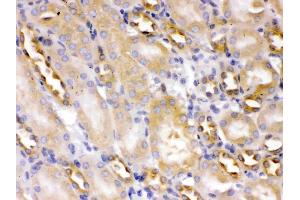 Alpha Actinin 4 was detected in paraffin-embedded sections of mouse kidney tissues using rabbit anti- Alpha Actinin 4 Antigen Affinity purified polyclonal antibody (Catalog # ) at 1 µg/mL. (alpha Actinin 4 抗体  (AA 561-661))