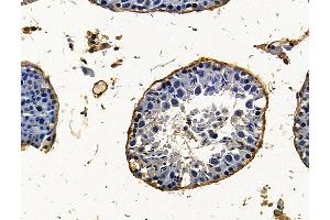 ABIN7096323 and ABIN7100385 at 1/100 staining mouse testis tissue by IHC-P. (PHF16 抗体)