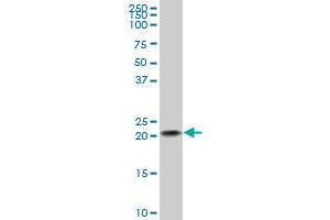 Western Blotting (WB) image for anti-NADH Dehydrogenase (Ubiquinone) 1 beta Subcomplex, 10, 22kDa (NDUFB10) (AA 73-172) antibody (ABIN561941)