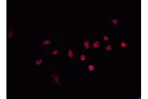 ABIN6268887 staining HeLa cells by IF/ICC. (PRKDC 抗体  (C-Term))