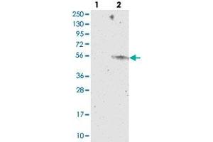 Western blot analysis of Lane 1: Negative control (vector only transfected HEK293T lysate), Lane 2: Over-expression Lysate (Co-expressed with a C-terminal myc-DDK tag (~3. (CYP2W1 抗体)