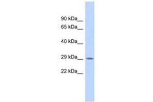 Image no. 1 for anti-Regulatory Factor X-Associated Protein (RFXAP) (AA 179-228) antibody (ABIN6740333) (RFXAP 抗体  (AA 179-228))