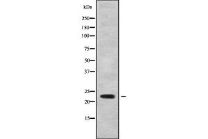 Western Blotting (WB) image for anti-Cysteine Dioxygenase, Type I (CDO1) (Internal Region) antibody (ABIN6260729)