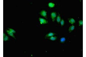 Immunofluorescence (IF) image for anti-Inhibitor of kappa Light Polypeptide Gene Enhancer in B-Cells, Kinase beta (IKBKB) (AA 395-588) antibody (ABIN7156261)