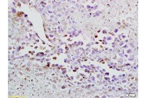 Immunohistochemistry (Paraffin-embedded Sections) (IHC (p)) image for anti-POU Class 5 Homeobox 1 (POU5F1) (AA 201-300) antibody (ABIN737826)