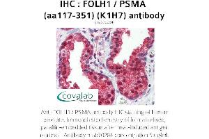 Image no. 2 for anti-Folate Hydrolase (Prostate-Specific Membrane Antigen) 1 (FOLH1) (AA 117-351) antibody (ABIN1723210) (PSMA 抗体  (AA 117-351))