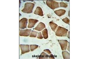 Formalin-fixed and raffin-embedded human skeletal muscle reacted with DI Antibody (Center), which was peroxidase-conjugated to the secondary antibody, followed by DAB staining. (CCDC85B 抗体  (AA 69-96))