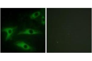 Immunofluorescence analysis of HeLa cells, using Collagen I alpha2 Antibody. (COL1A2 抗体  (AA 471-520))