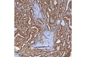 IHC analysis of TRMT61A using anti-TRMT61A antibody (ABIN7599220).