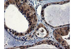 Image no. 8 for anti-CCR4-NOT Transcription Complex Subunit 4 (CNOT4) (AA 190-455) antibody (ABIN1491098)