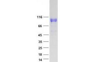 Validation with Western Blot