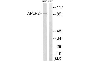 Western blot analysis of extracts from rat brain cells, using APLP2 (Ab-755) antibody. (APLP2 抗体  (Tyr755))