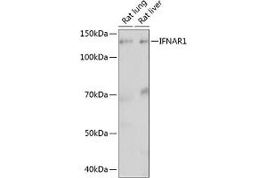 Western blot analysis of extracts of various cell lines, using IFN Rabbit mAb (ABIN1682980, ABIN3015227, ABIN3015228 and ABIN7101324) at 1:1000 dilution. (IFNAR1 抗体)
