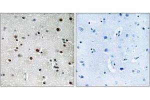 Immunohistochemistry analysis of paraffin-embedded human brain tissue, using RFX3 Antibody. (RFX3 抗体  (AA 641-690))