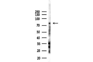 Western blot analysis of lysates from Rat testis, using CTNNAL1 Antibody at 1/1000 dilution.