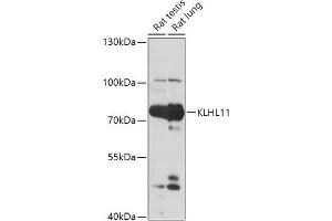Western blot analysis of extracts of various cell lines, using KLHL11 antibody (ABIN7268078) at 1:1000 dilution. (KLHL11 抗体  (AA 16-300))