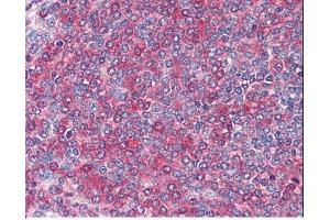 Image no. 1 for anti-Frizzled Family Receptor 7 (FZD7) (C-Term) antibody (ABIN374921) (FZD7 抗体  (C-Term))