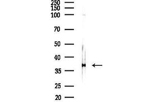 anti-gamma-Glutamyl Hydrolase (Conjugase, Folylpolygammaglutamyl Hydrolase) (GGH) (C-Term) antibody