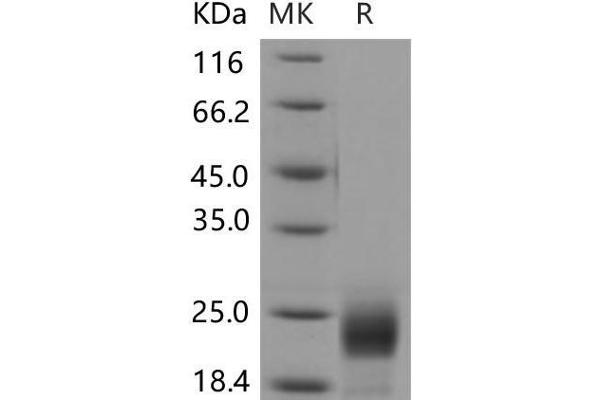 DCL1 Protein (His tag)