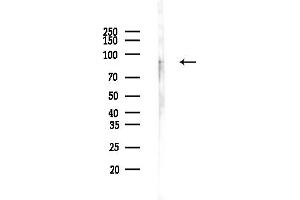 anti-Extracellular Matrix Protein 2, Female Organ and Adipocyte Specific (ECM2) (Internal Region) antibody