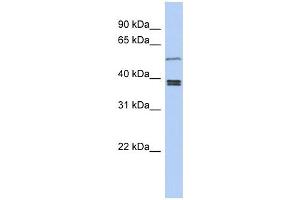 SS18L1 antibody used at 1 ug/ml to detect target protein. (SS18L1 抗体  (Middle Region))